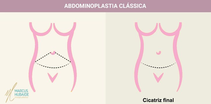 abdo-classica