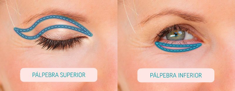 palpebras