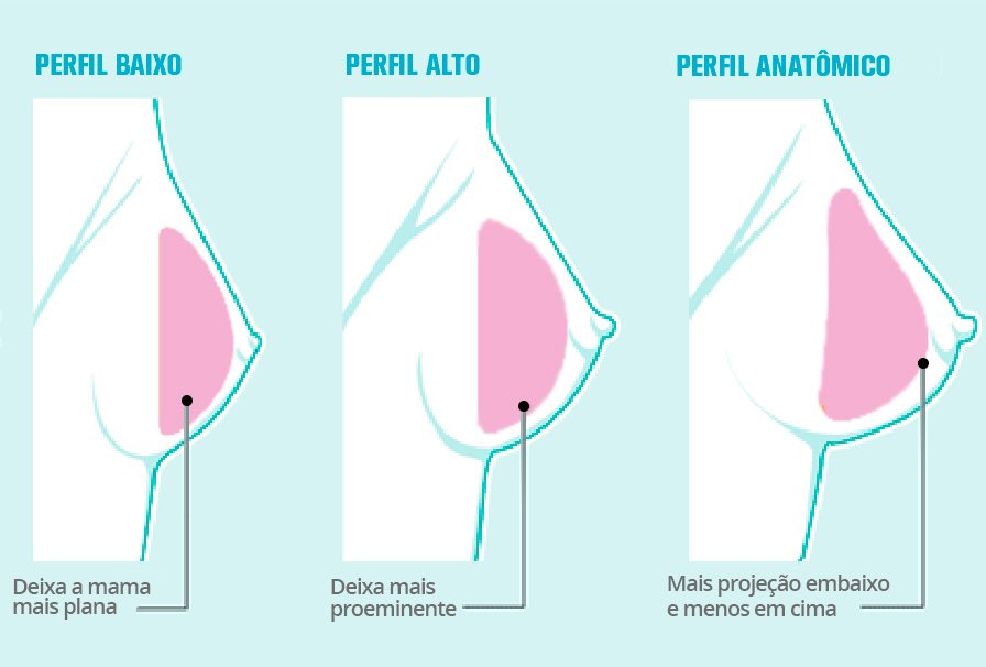 protese-de-mama