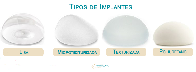 tipos-de-proteses